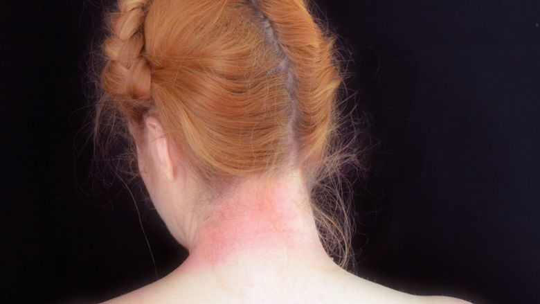 image of woman's neck 